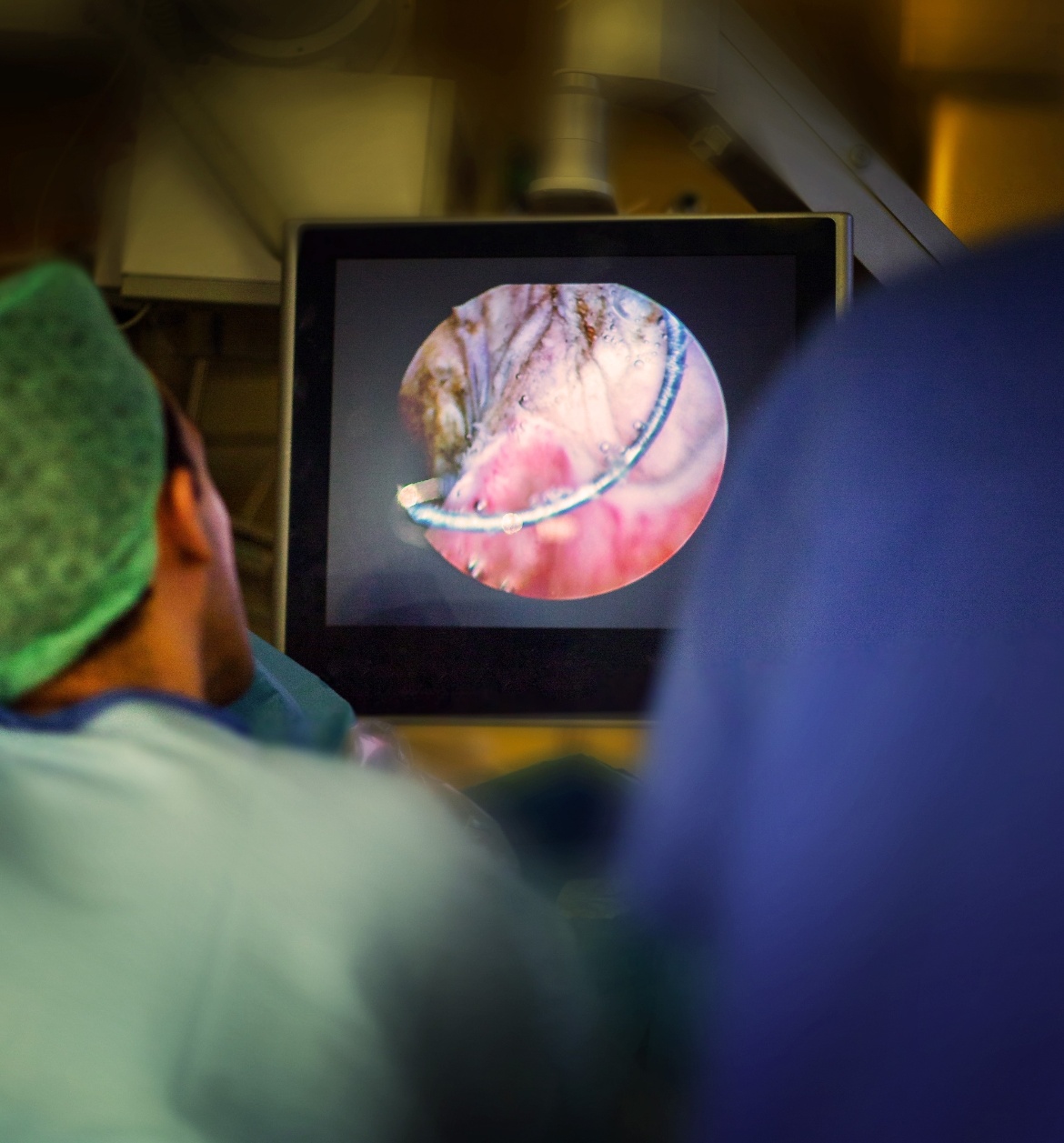 Blick auf das Kamerabild in einer urologischen OP am Universitätsklinikum Tübingen.